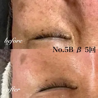 オールハンド フェイシャルのエステ・リラクイメージ