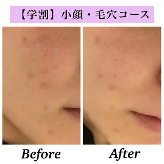 Bellesthe （ベルエステ）のエステ・リラクイメージ