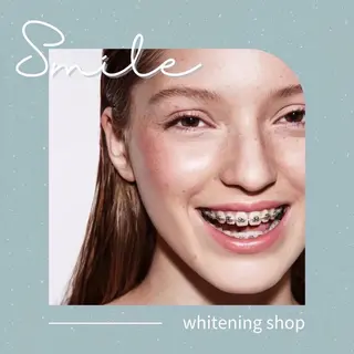 ホワイトニングショップ伊丹店所属・ホワイトニング ショップ伊丹店のその他イメージ