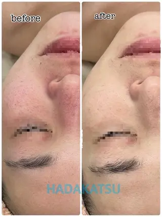 総合エステサロン 肌活のエステ・リラクイメージ