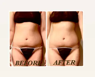 Prima〜プリマ〜 名古屋駅店所属・Prima 痩身脱毛 にごうかおりのエステ・リラクイメージ