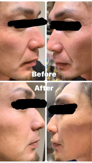 eyelist Asamiのマツエク・マツパデザイン