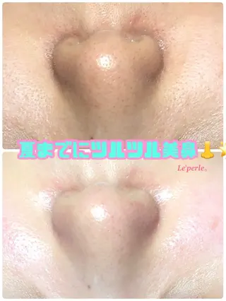 Le'perle｡所属・Le'perle｡ Kyokaのエステ・リラクイメージ