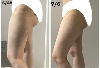 Le Cherien所属・姫路/肌管理/脱毛 Le Cherienのその他イメージ