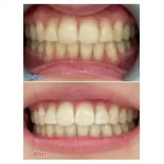 M渋谷店所属・Ｍ渋谷 ホワイトニングのエステ・リラクイメージ