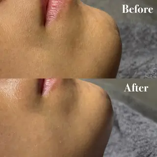 眉毛と韓国肌質改善 サロン　和泉府中のエステ・リラクイメージ