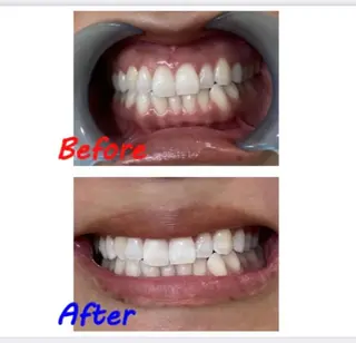 セルフホワイトニングサロン　ラヴィアン所属・ホワイトニングサロン La vie enのその他イメージ