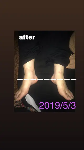 【足圧】鬼👹リンパ 身体整うサロンのエステ・リラクイメージ