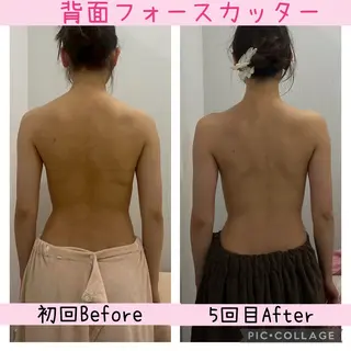 ブライダル痩身×脱毛 尼崎駅前サロンのエステ・リラクイメージ