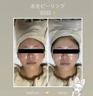 脱毛サロン エクボスタッフのエステ・リラクイメージ