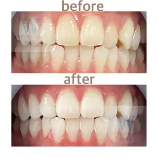 ホワイトニング ショップ船橋店🦷のエステ・リラクイメージ