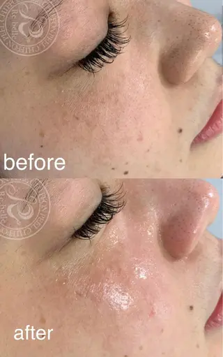 Lavi&所属・肌質改善サロン Lavi&のその他イメージ