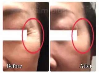 首肩こり専門サロン Kalnicco/カルニッコ所属・首肩こり専門サロン Kalniccoのエステ・リラクイメージ