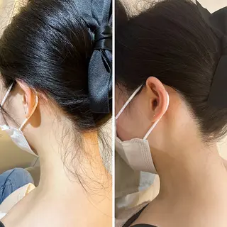 うなじ脱毛/美肌脱毛 LABELのエステ・リラクイメージ