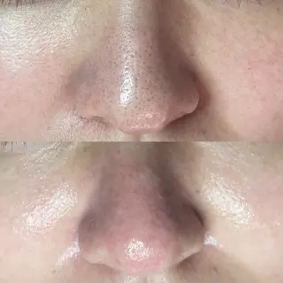 毛穴・シミ専門店MeMe多治見店所属・MeMe 多治見のエステ・リラクイメージ