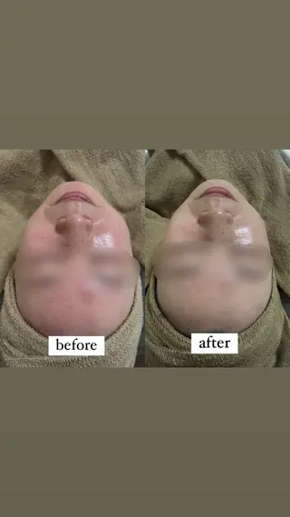 haneul ‹ハヌル›のエステ・リラクイメージ