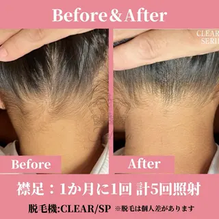 キッズ 有人型セルフサロン 脱毛/痩身/美顔のその他イメージ