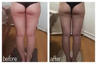 biloop所属・《痩身×疲労改善》 BILOOPのエステ・リラクイメージ