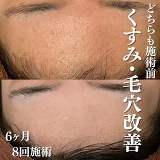 触れたくなる モテ肌へ...❤︎のエステ・リラクイメージ