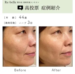 Liberte リベルテ(トモ化粧品店内)所属・RINA 🍒のマツエク・マツパデザイン