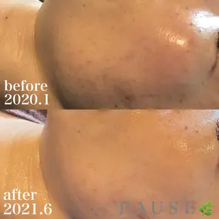 浜野 恵美のエステ・リラクイメージ