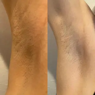 脱毛SALON RaYNiCKのエステ・リラクイメージ