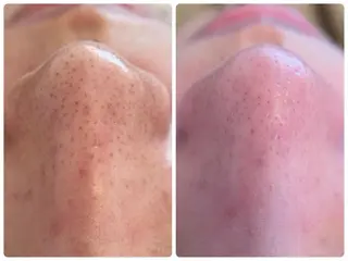 Hisui 小出のエステ・リラクイメージ