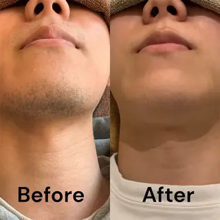 LaLuce所属・石井 真央のエステ・リラクイメージ