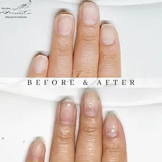 ネイル 深爪・巻き爪 専門サンセリテのネイルデザイン