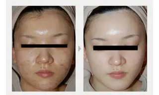 M. lisyelのエステ・リラクイメージ