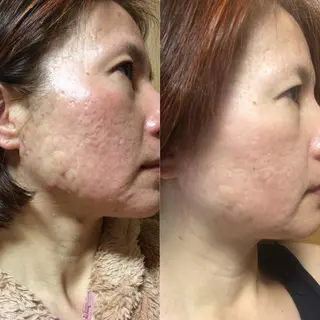 hotty ホッティーのエステ・リラクイメージ