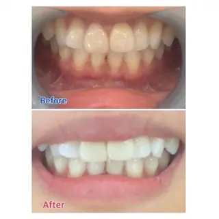 M渋谷店所属・Ｍ渋谷 ホワイトニングのエステ・リラクイメージ