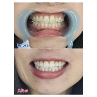 MBEAUTYSALON 千葉店・京成大久保所属・Melty 輝のその他イメージ