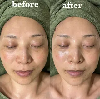 【肌質改善サロン】 リーフィアのエステ・リラクイメージ