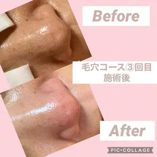 COCOPURE. 凪..のエステ・リラクイメージ