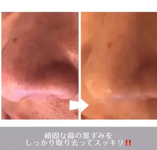 ラ・ルミエール所属・鈴木 えつこのエステ・リラクイメージ