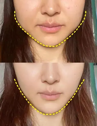 aliaハイフ&水光ジェットサロン所属・aliaハーブ水光店 エステティシャン募集のエステ・リラクイメージ