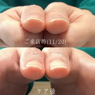 ネイル Aim* 深爪・自爪育成専門店のネイルデザイン