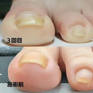 ネイル Micky nail chikushinoのその他イメージ