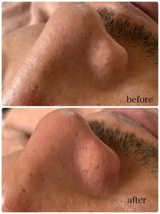 美BODY美FACEサロンjewelbouquet所属・jewel bouquetのエステ・リラクイメージ