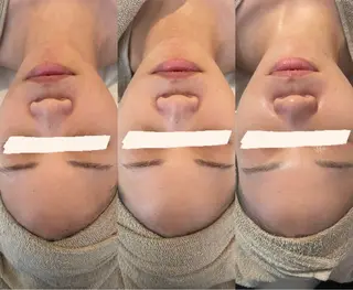 中目黒ハーブピーリン グ🌿ララピールのエステ・リラクイメージ