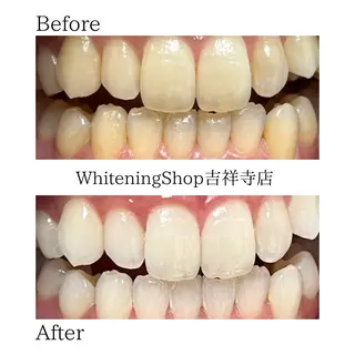 ホワイトニング ショップ吉祥寺店のエステ・リラクイメージ