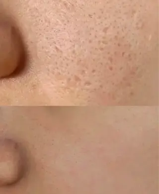 マツエク・マツパ aliaハイフ&水光ジェットサロン所属・aliaハーブ水光店 エステティシャン募集のエステ・リラクイメージ