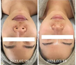 Esthe salon Blanche(エステサロンブランシュ)所属・小顔リフトアップ 美肌改善専門店のエステ・リラクイメージ