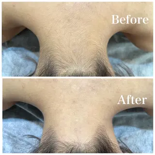 脱毛サロン fam.豊澤柚良のエステ・リラクイメージ