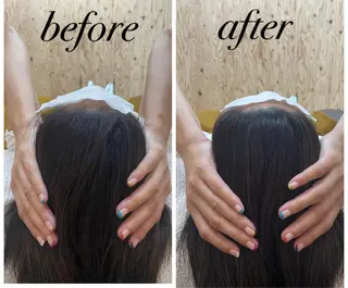 ate'所属・個室ドライヘッドスパ 🍃moriのエステ・リラクイメージ