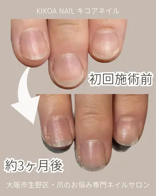 ネイル KIKOA NAIL キコアネイルのネイルデザイン