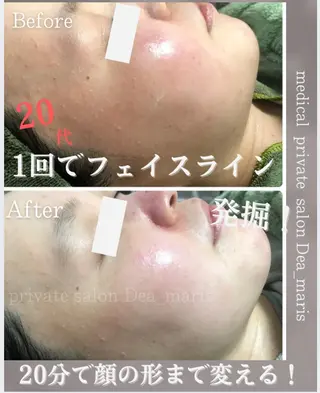 private salon  Dea_maris シュガーリング＆パーソナルボディケア所属・シミ改善・韓国肌管理 ボディメイク痩身のその他イメージ
