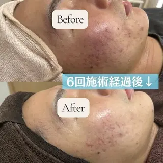 朝廣 紗弥のマツエク・マツパデザイン