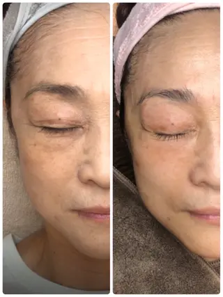 かすがい鍼灸院Re.heart所属・かすがい鍼灸院 Re.heartのエステ・リラクイメージ